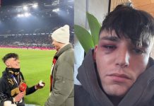 Niemcy: Czy sędzia upozorował homofobiczny atak? Trwa śledztwo