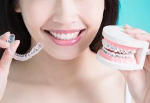 Aparat ortodontyczny Invisalign w Niemczech: Koszty, przebieg oraz najważniejsze informacje!