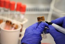 EHEC w Niemczech: Dwanaście potwierdzonych zakażeń w Meklemburgii-Pomorzu Przednim