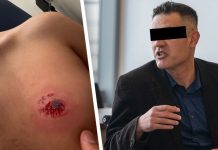 Niemcy: Syryjczyk zarażony wirusem HIV pogryzł 17-latka podczas sprzeczki drogowej. Teraz stanął przed sądem