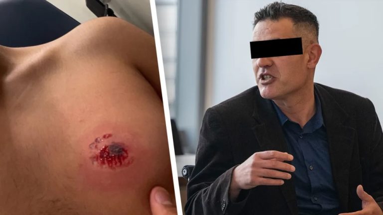 Niemcy: Syryjczyk z HIV ugryzł 17-latka za zbyt wolną jazdę – sąd wydał zaskakująco łagodny wyrok