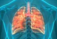 Niemcy: Gruźlica w przedszkolu – 130 osób musi przejść badania krwi