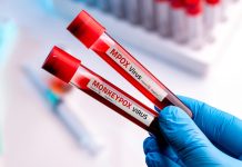 Niepokojący raport z Berlina: Gwałtowny wzrost zakażeń Mpox. Wirus dotarł do nowej grupy