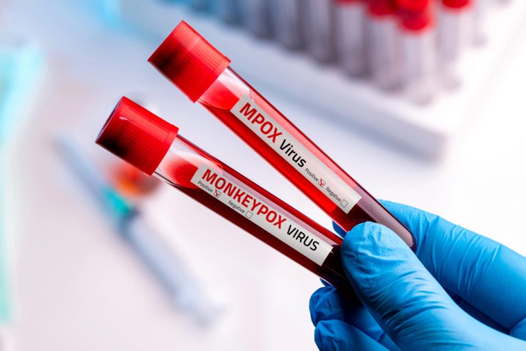 Niepokojący raport z Berlina: Gwałtowny wzrost zakażeń Mpox. Wirus dotarł do nowej grupy