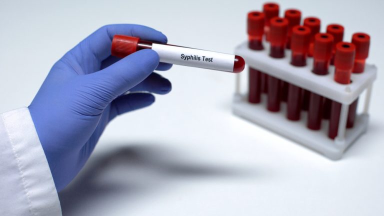 Niemcy: Rekordowa liczba zakażeń kiłą w 2024 roku – Instytut Roberta Kocha bije na alarm