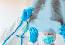 Niemcy: Drugi przypadek gruźlicy w szkołach średnich w Bonn w ciągu miesiąca