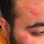 Omar ofiara przemocy policyjnej-min