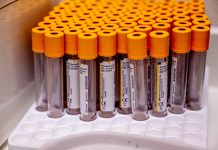 Niemcy: Rekordowa liczba zakażeń kiłą w 2024 roku – Instytut Roberta Kocha bije na alarm