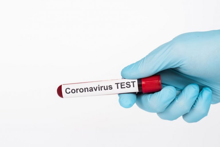 Bawaria planuje bezpłatne testy na koronawirusa dla wszystkich obywateli!