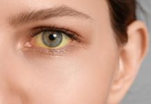 Niemcy: Liczba przypadków wirusowego zapalenia wątroby wzrosła ponad dwukrotnie – skok dzięki lepszemu wykrywaniu