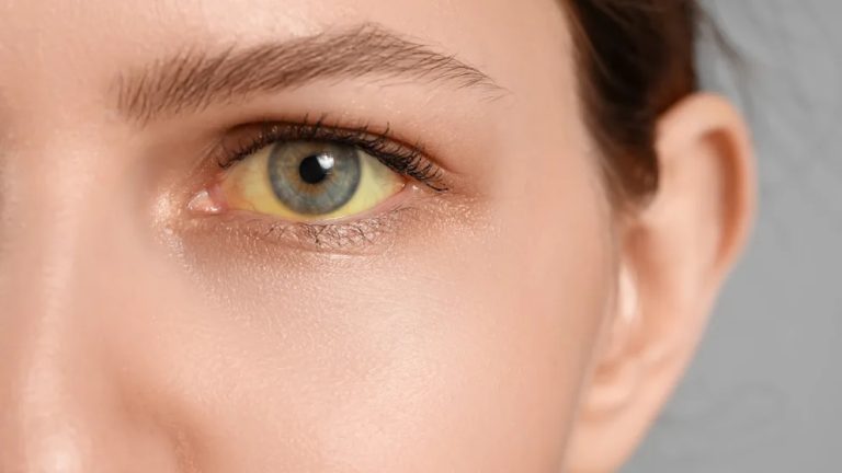 Niemcy: Liczba przypadków wirusowego zapalenia wątroby wzrosła ponad dwukrotnie – skok dzięki lepszemu wykrywaniu