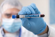 Niemiecki Instytut Roberta Kocha odnotował już dziesięć przypadków zakażeń wirusem Zachodniego Nilu w tym sezonie