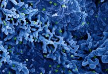 Pierwszy przypadek nowego wariantu wirusa Mpox w Niemczech