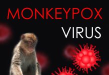 Liczba zachorowań na małpią ospę w Niemczech wzrosła do 113. Wszyscy zakażeni to mężczyźni