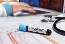 Instytut Roberta Kocha: dwoje nastolatków zakażonych małpią ospą