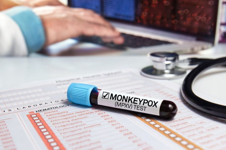 WHO: już 780 przypadków małpiej ospy w 27 krajach spoza Afryki