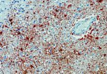 Bawaria: Mężczyzna zmarł w wyniku zakażenia wirusem Borna