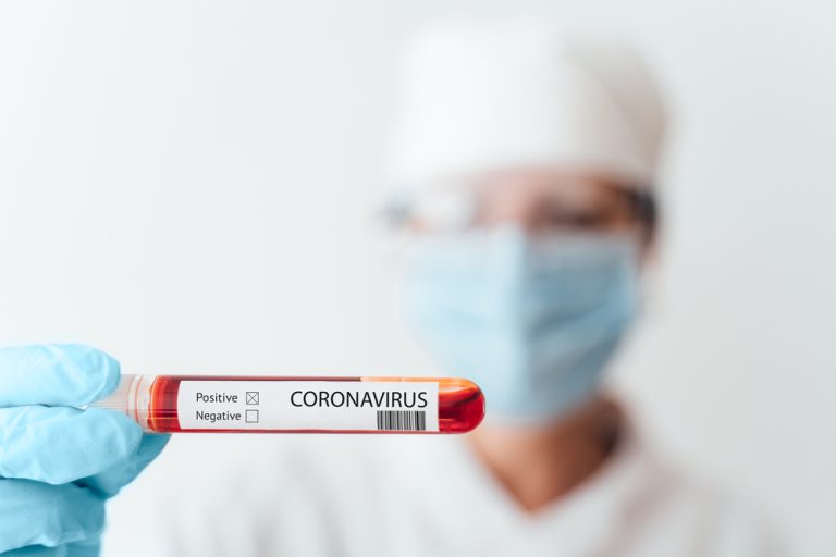 Niemcy: szpitale będą wreszcie prawidłowo liczyć pacjentów z koronawirusem