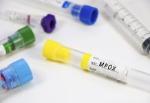 Gwałtowny wzrost zachorowań na Mpox w Berlinie. Po raz pierwszy wykryto nowy wariant wirusa