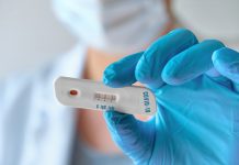 Od poniedziałku darmowe szybkie testy na koronawirusa w Berlinie, pozostałe kraje związkowe wciąż nieprzygotowane