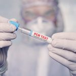 test pcr