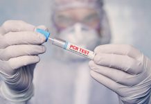 Niemcy: 81 417 nowych zachorowań na koronawirusa, na wyniki testów trzeba czekać aż do 5 dni!