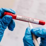 testy dla turystów powracaących do Niemiec